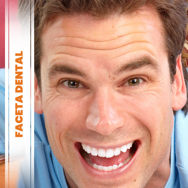 Saiba mais sobre Faceta Dental Faceta Dental