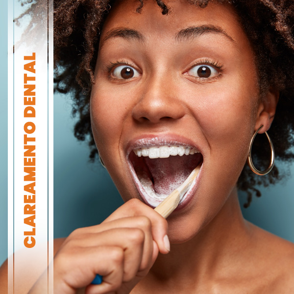 Saiba sobre Clareamento Dental clareamento dental